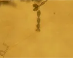 Alternaria alternata – plamistość liści i zgnilizna owoców