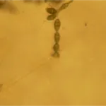 Alternaria alternata – plamistość liści i zgnilizna owoców