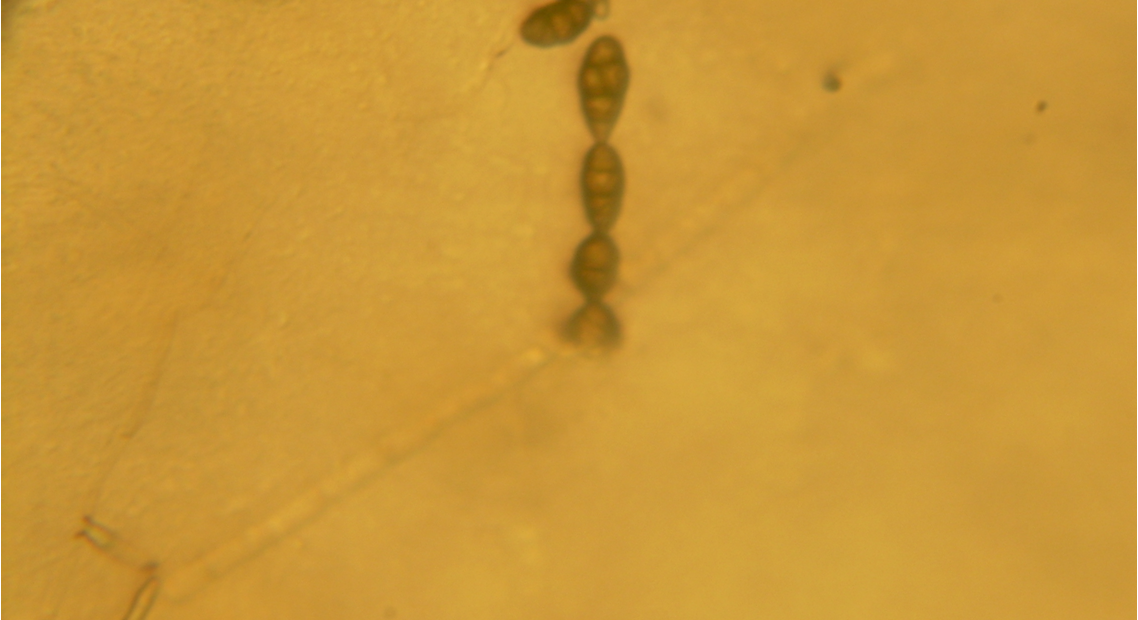 Alternaria leaf spot and fruit rot