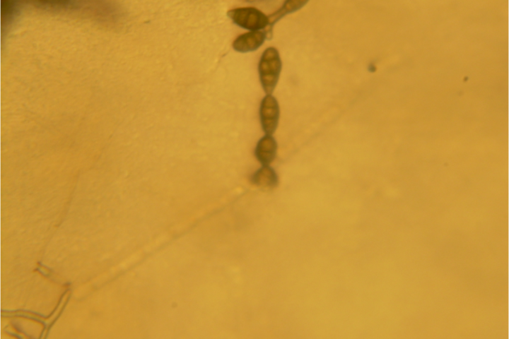 Alternaria leaf spot and fruit rot