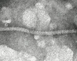 Apfelstammfurchungsvirus