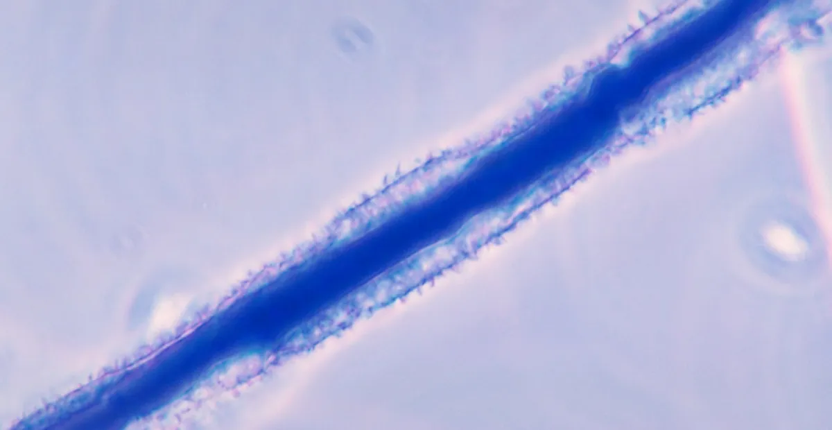 Aspergillus ear rot and aflatoxin contamination