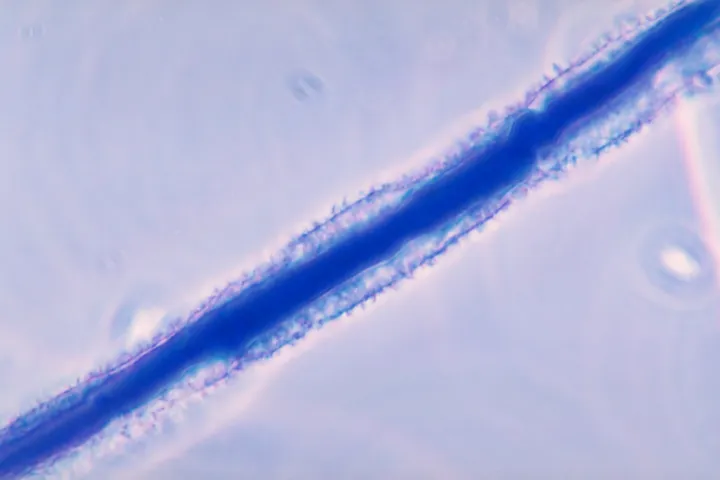 Aspergillus ear rot and aflatoxin contamination
