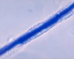Aspergilová hniloba a kontaminácia aflatoxínmi