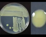 Bacterial Leaf Streak of Small-Grain Cereals
