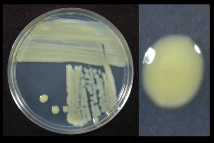 Bacterial Leaf Streak of Small-Grain Cereals