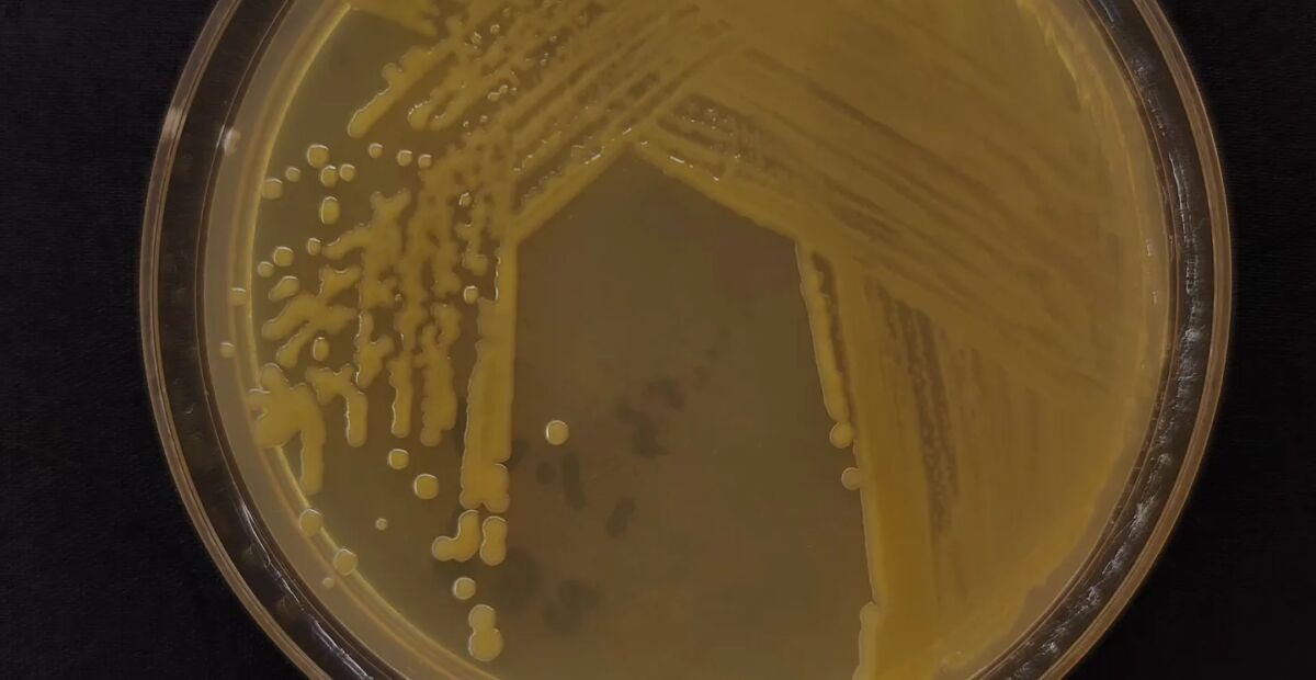 Bakteriálna škvrnitosť a hniloba spôsobená Pseudomonas viridiflava
