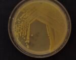 Bakterielle Blatt-, Stängel- und Fruchtfäule durch Pseudomonas viridiflava