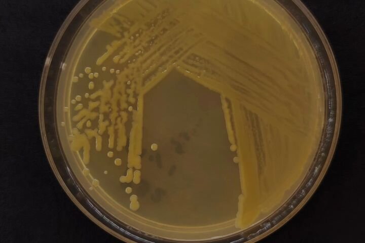 Bakterielle Blatt-, Stängel- und Fruchtfäule durch Pseudomonas viridiflava