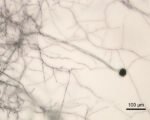 Čierna pleseň (Aspergillus niger)