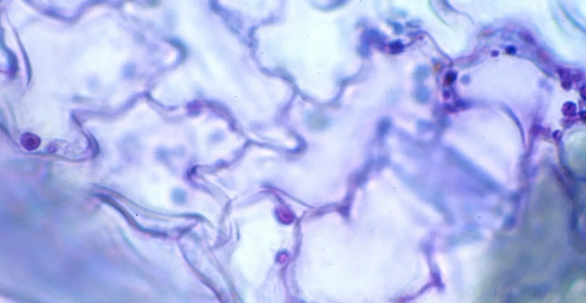 Cucumber mosaic virus