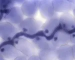 Downy Mildew Caused by Hyaloperonospora parasitica