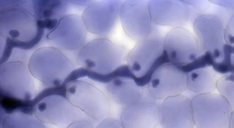 Downy Mildew Caused by Hyaloperonospora parasitica