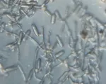 Leveillula taurica powdery mildew