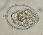 Phytophthora cactorum (Kragen-, Lederbeeren- und Rhizomfäule)