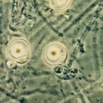 Phytophthora-Fäule durch Phytophthora palmivora