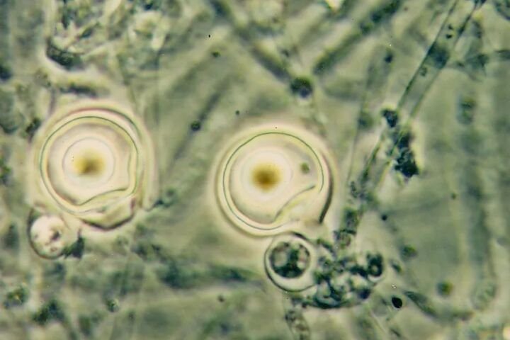 Phytophthora-Fäule durch Phytophthora palmivora