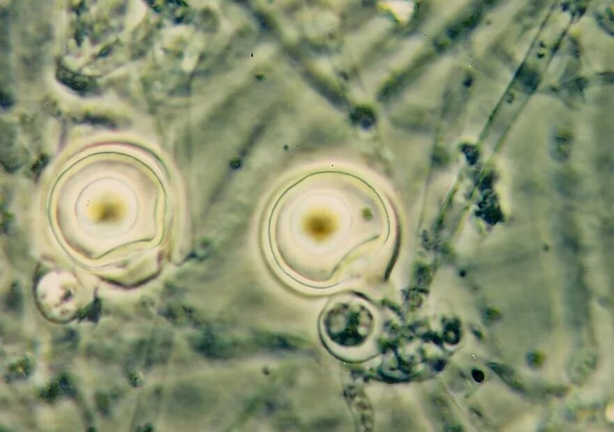 Phytophthora-Fäule durch Phytophthora palmivora