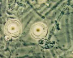 Phytophthora palmivora Bud Rot