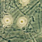 Phytophthora palmivora Bud Rot