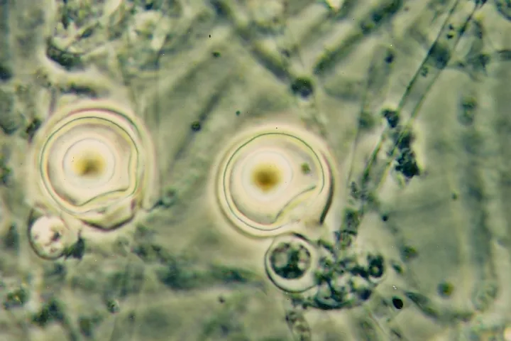 Phytophthora palmivora Bud Rot