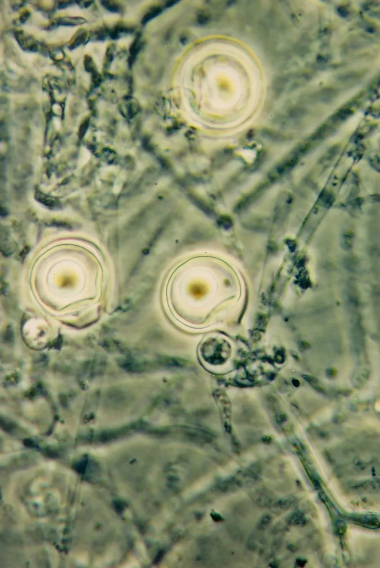 Phytophthora palmivora Bud Rot – diagnostic photo
