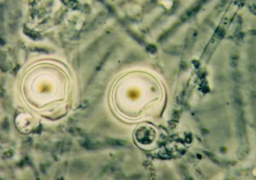 Phytophthora palmivora Bud Rot