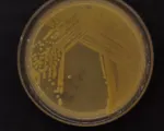 Pseudomonas viridiflava bacterial blight