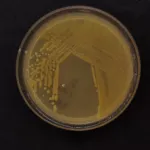 Pseudomonas viridiflava bacterial blight