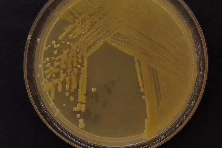 Pseudomonas viridiflava bacterial blight