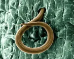 Southern root-knot nematode