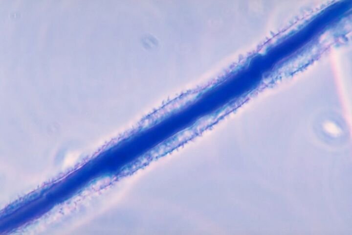 Zgnilizna kolb kukurydzy powodowana przez Aspergillus flavus i skażenie aflatoksynami