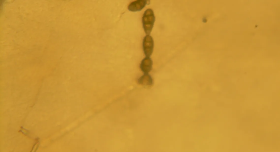 Alternariosi da Alternaria alternata