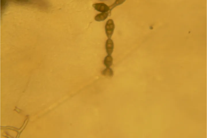 Alternariosi da Alternaria alternata